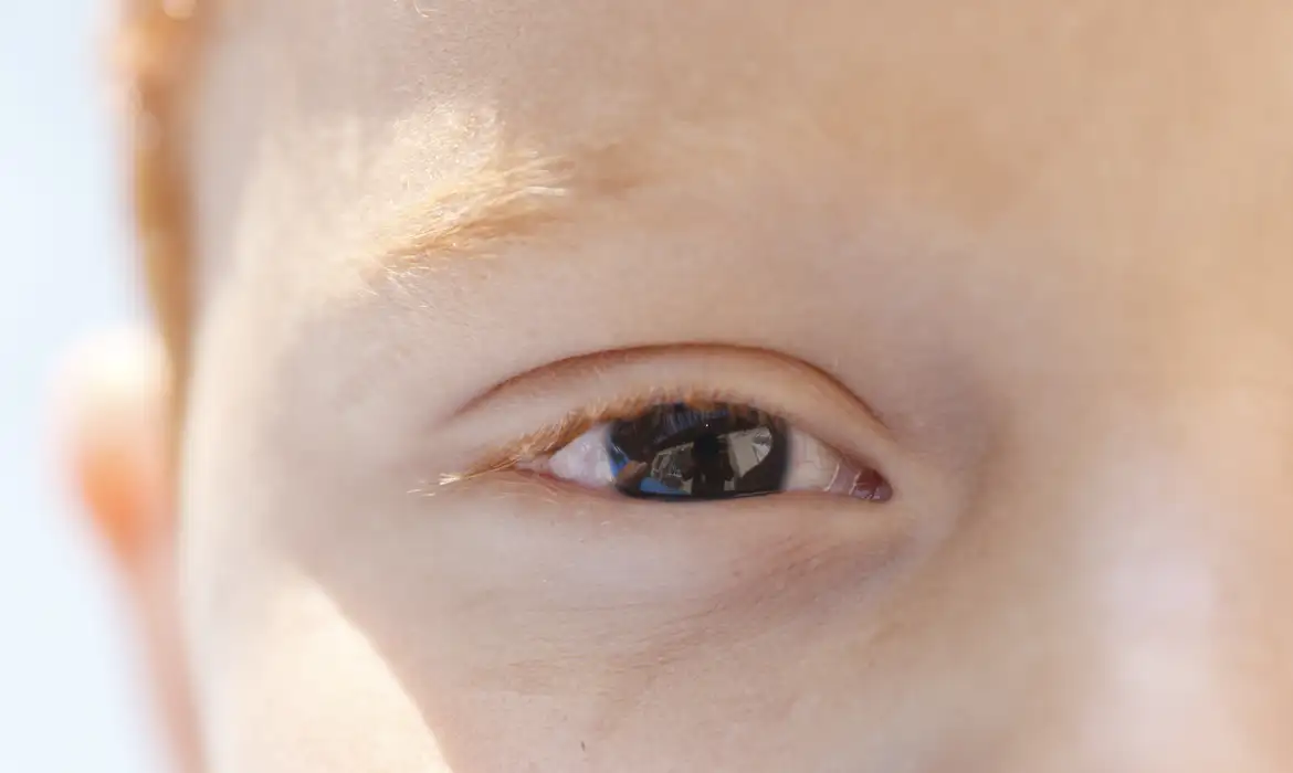 Erros de refração lideram causas de deficiência visual infantil, aponta CBO - Imagem do artigo original